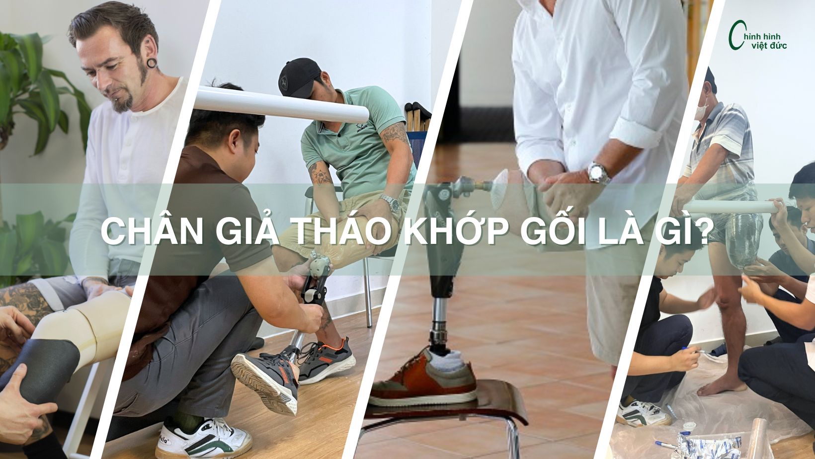 Chân giả tháo khớp gối