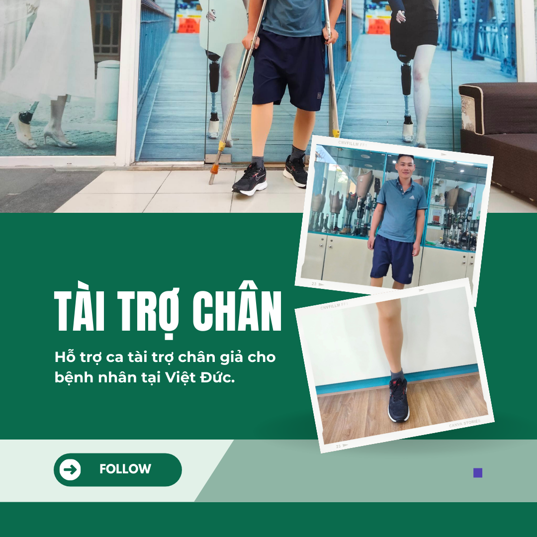 tài trợ chân giả trên gối