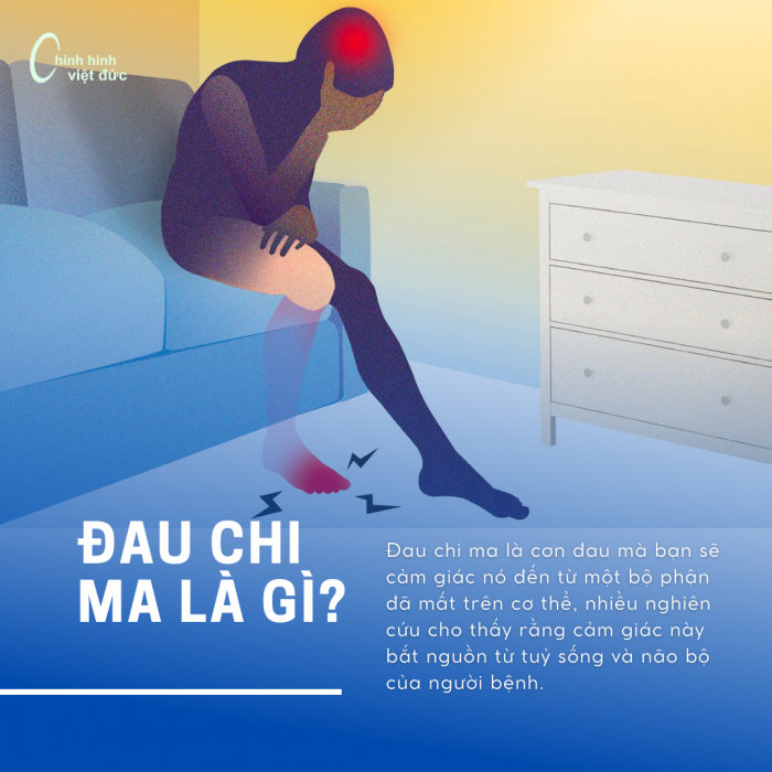 ĐAU CHI MA LÀ GÌ BẠN CÓ BIẾT (1)