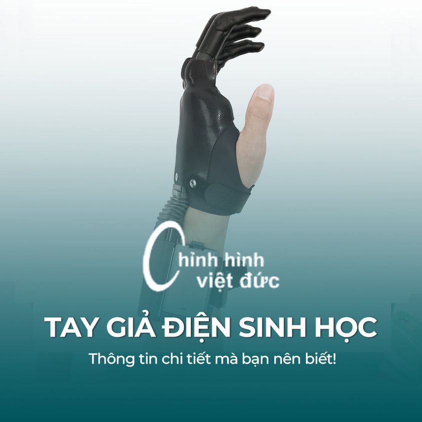 Nguồn: Chỉnh Hình Việt Đức